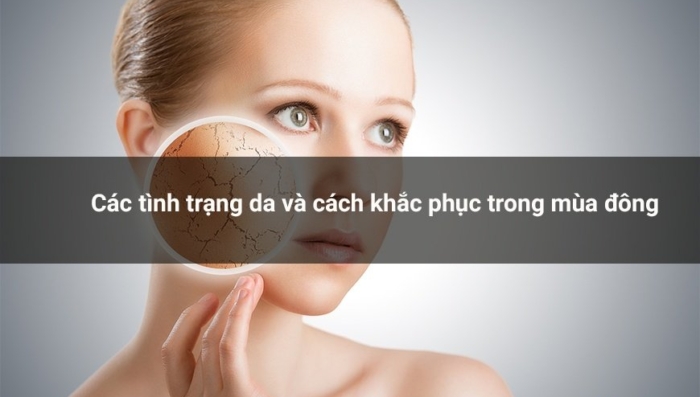 Mách bạn cách khắc phục các tình trạng da hay gặp mùa thu đông
