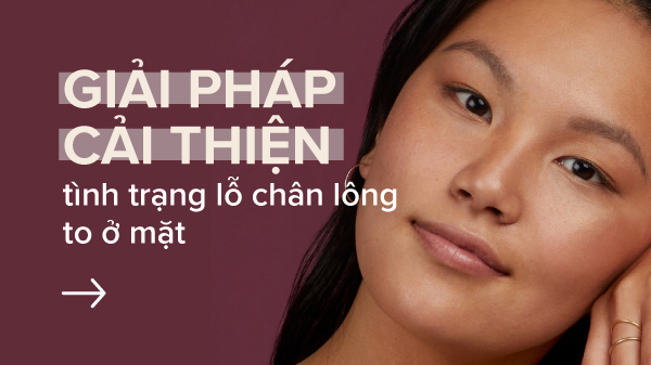 Lỗ chân lông to – Nguyên nhân và cách khắc phục